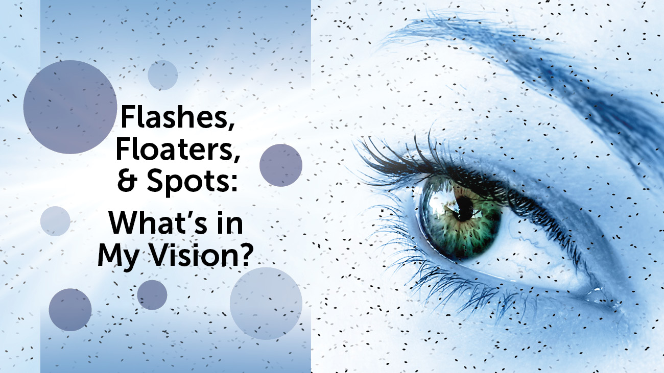 Do you see spots in your vision? | What is normal and what is not?