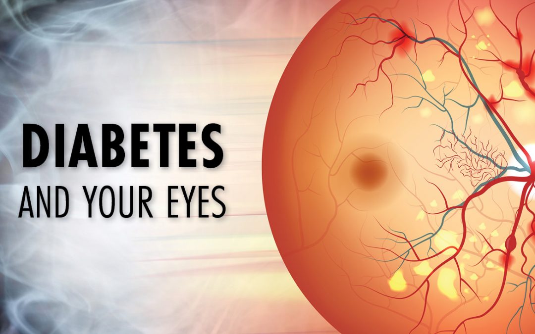 Diabetes and Your Eyes